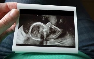 Unexpected Pregnancy Leads to Supportive Adoption